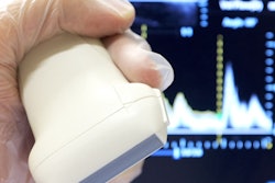 2018 12 03 21 52 9010 Ultrasound Probe Vascular 400