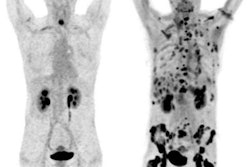 2019 06 11 21 55 7445 Ga68 Fapi Pet Ct Jnm 400