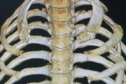 2019 06 15 00 36 8107 3 D Printed Ribs 400