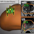 2019 06 17 22 51 6335 Mri Biopsy Prostate Jama 20190617224516