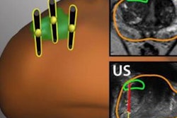 2019 06 17 22 51 6335 Mri Biopsy Prostate Jama 20190617224516