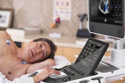 2019 06 20 17 07 4845 Philips Epiq Cvx 400