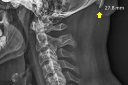 2019 06 20 23 50 9328 Radiograph Skull Horns 400