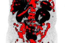 2019 06 23 21 43 9978 2019 06 23 Lu 177 Pmsa Pet 20190623220617