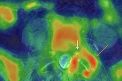 2019 06 24 00 47 0834 Snmmi Pet Mri Pain Biswal 600 20190624005610
