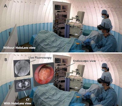 AR technology enables clinicians to look at CT scans alongside a real-time endoscopic view of patient anatomy during minimally invasive procedure simulations. Image courtesy of Al Janabi et al. Licensed under CC BY 4.0