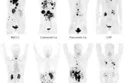 2019 06 26 01 41 9711 Snmmi 2019 Image Of The Year Giesel Final 400