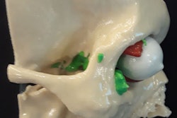 2019 06 27 21 19 7393 3 D Printed Skull 400