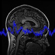 2018 08 15 16 13 8766 Brain Waves 400 20180815163458