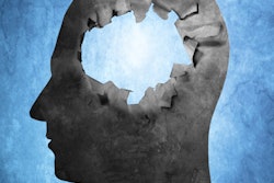 2018 08 17 22 56 4211 Brain2 Hole 400