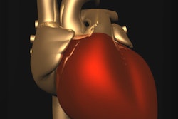 2018 10 24 22 23 8807 Heart Metallic Red Gold 400