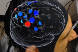 2019 07 09 22 30 5612 Clarai Brain 400