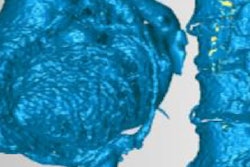 2019 07 11 22 32 6021 3 D Heart Spine 400