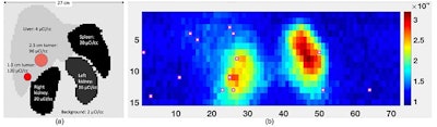 Maximum intensity projection shows relative positions of organs and tumors in the simulations with sample activity levels and plot of counts for 2D detector array (b). Red boxes represent detector positions that the algorithm selected for optimal dose estimation. The vest covers approximately 18 cm of the torso. Images courtesy of Miyaoka et al and SNMMI.
