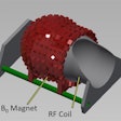 2019 07 15 18 03 3729 Ismrm Whole Brain Mri Prototype Am Mri Insider Thumb 20190715185456