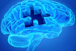 2019 07 17 22 41 3854 Brain Puzzle Dementia 400