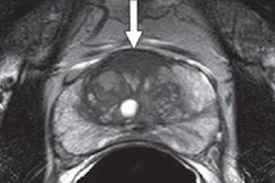 2019 07 23 21 55 8633 Mri Biopsy Prostate Ajr Meermeier 01 400 20190723213124