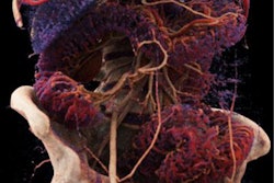 2019 07 29 22 57 8846 Cinematic Rendering Colitis 20190729222501