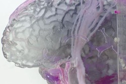 2019 07 30 23 43 6343 3 D Printed Brain Mri 600 20190730230405
