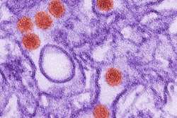 2016 11 22 15 58 24 308 Zika Virus 400