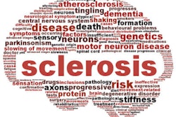 2017 08 08 16 36 45 75 Multiple Sclerosis 400