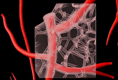 Virtual depiction of part of a 3D-bioprinted model of cardiac vasculature made with collagen bioink. Image courtesy of Carnegie Mellon University College of Engineering.