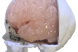 2019 08 07 21 52 8665 3 D Printing Neurosurgery 400