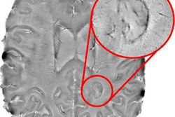 2019 08 13 22 04 4334 Brain Mri Ms 20190813222347