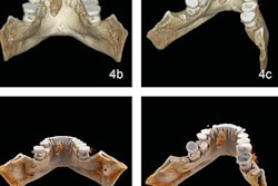 2019 08 16 22 17 4211 Cinematic Rendering Mouth 20190816225654