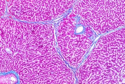 2019 08 20 17 58 3943 Pathology Slide Liver 400