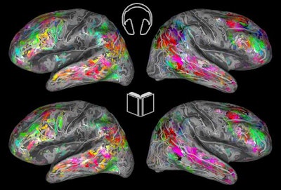 Color-coded fMRI maps of the brain show the semantic similarities during listening (top) and reading (bottom). Images courtesy of Fatma Deniz of the University of California, Berkeley.