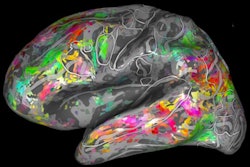 2019 08 20 23 49 1159 2019 08 21 F Mri Maps Brain Activation Thumb