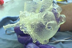 2019 08 22 23 37 6549 3 D Printed Heart 20190822232011