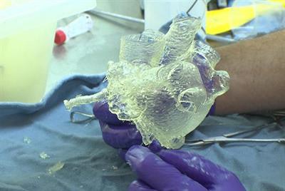 A patient-specific 3D-printed heart model. Image courtesy of UW Medicine/Seattle.