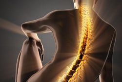 2019 08 27 17 28 9425 X Ray Spine Back 20190827173511