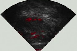 2019 08 27 18 26 8947 2019 08 28 Truspa 400