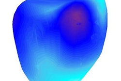 2019 08 29 00 00 1897 2019 08 29 3 D Cardiac Mri 20190829001240