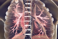 2019 08 27 21 25 7040 Tuberculosis Lungs 400