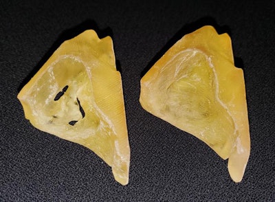 Sterilizable 3D-printed models of the orbital bone with a fracture (left) and after repair (right). Image courtesy of Dr. William Weadock.