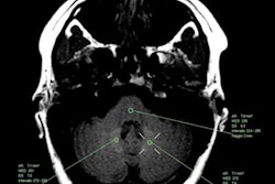 2019 09 09 21 46 6170 2019 09 10 Gbca Signal Intensity Ms Patients 500 20190909211549
