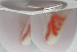 2019 09 12 16 36 5448 2019 09 13 3 D Printed Organs 20190912165431