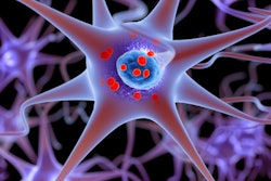 2019 09 12 18 06 9849 Parkinsons Lewy Bodies 400