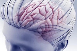 2019 09 12 21 47 8619 2019 09 12 Head Brain Aha Stroke 20190912213433