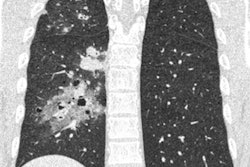 2019 09 16 20 36 0563 2019 09 17 Uhr Ct Coronal 20190916204759