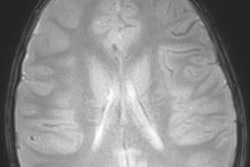 2019 09 17 22 12 9629 Fast Mri Lindberg 400