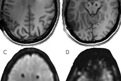 2019 09 20 18 01 3422 Deep Brain Stimulation Mri Boutet 20190920183032
