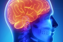 2017 04 14 10 55 26 413 Brain General 400