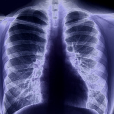2019 03 27 20 35 9511 X Ray Chest Lungs2 400