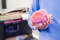 2019 05 28 19 42 5203 3 D Printed Heart 400