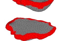 2019 10 02 21 55 8691 Mri Flat Placenta 20191002215817